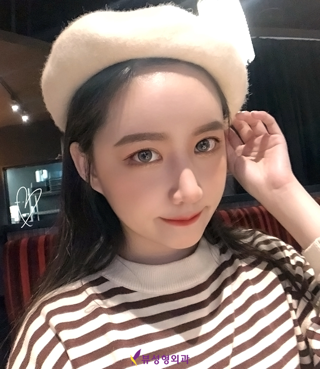 뷰성형외과 코성형잘하는곳 그 이유는? 관련 이미지 5