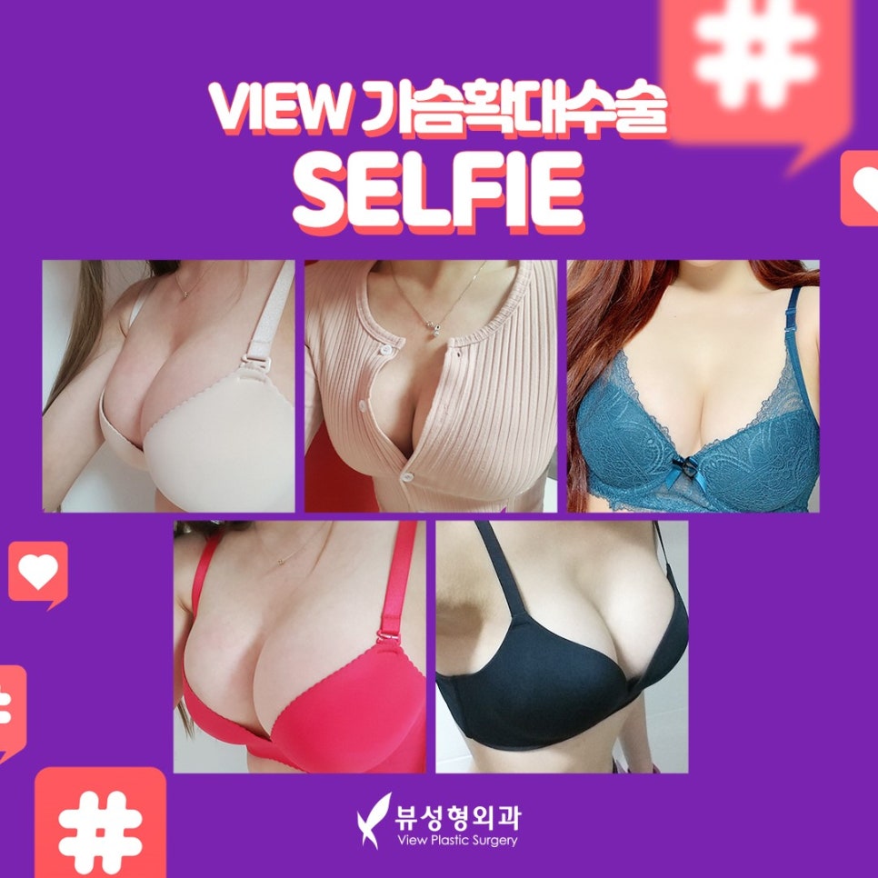 모티바가슴성형 자연스러운 결과를 원한다면 뷰성형외과 관련 이미지 4