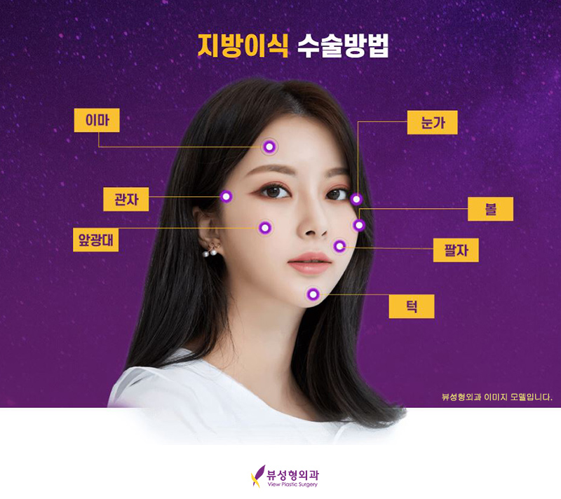 밋밋한 얼굴을 볼륨감 있게 입체적으로 개선하는 지방이식 관련 이미지 5