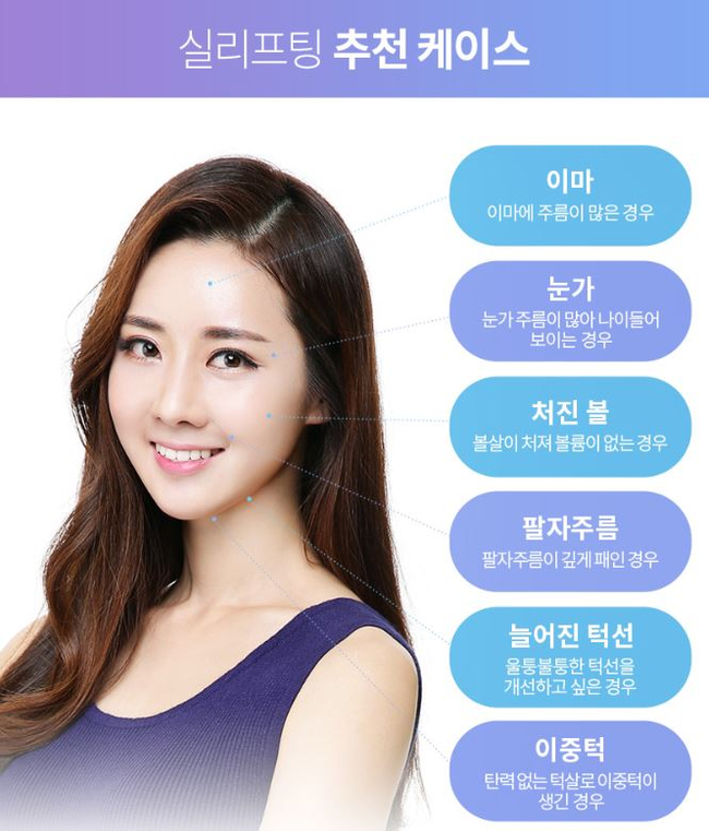 실리프팅후기 탄력 있는 얼굴의 비결은 뷰성형외과 관련 이미지 7