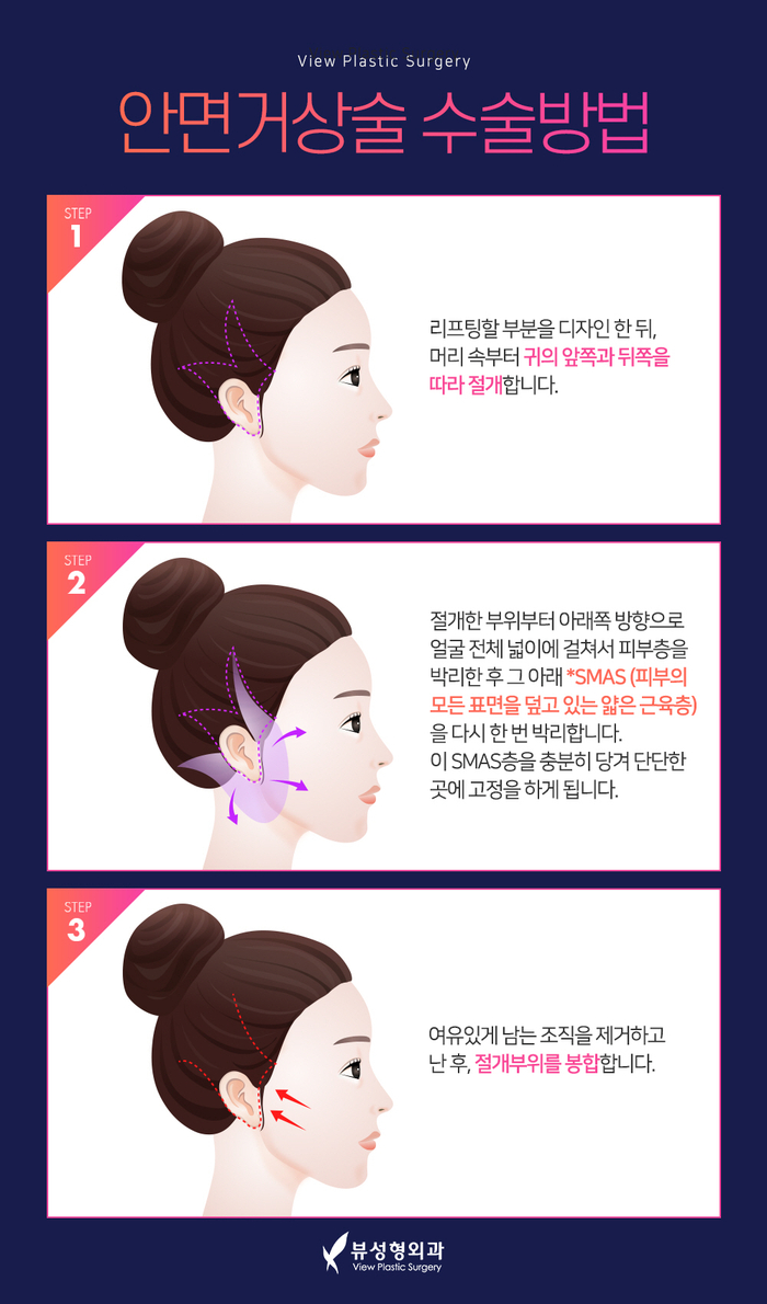 실리프팅 VS 안면거상술, 피부 상태에 맞는 맞춤리프팅 관련 이미지 15