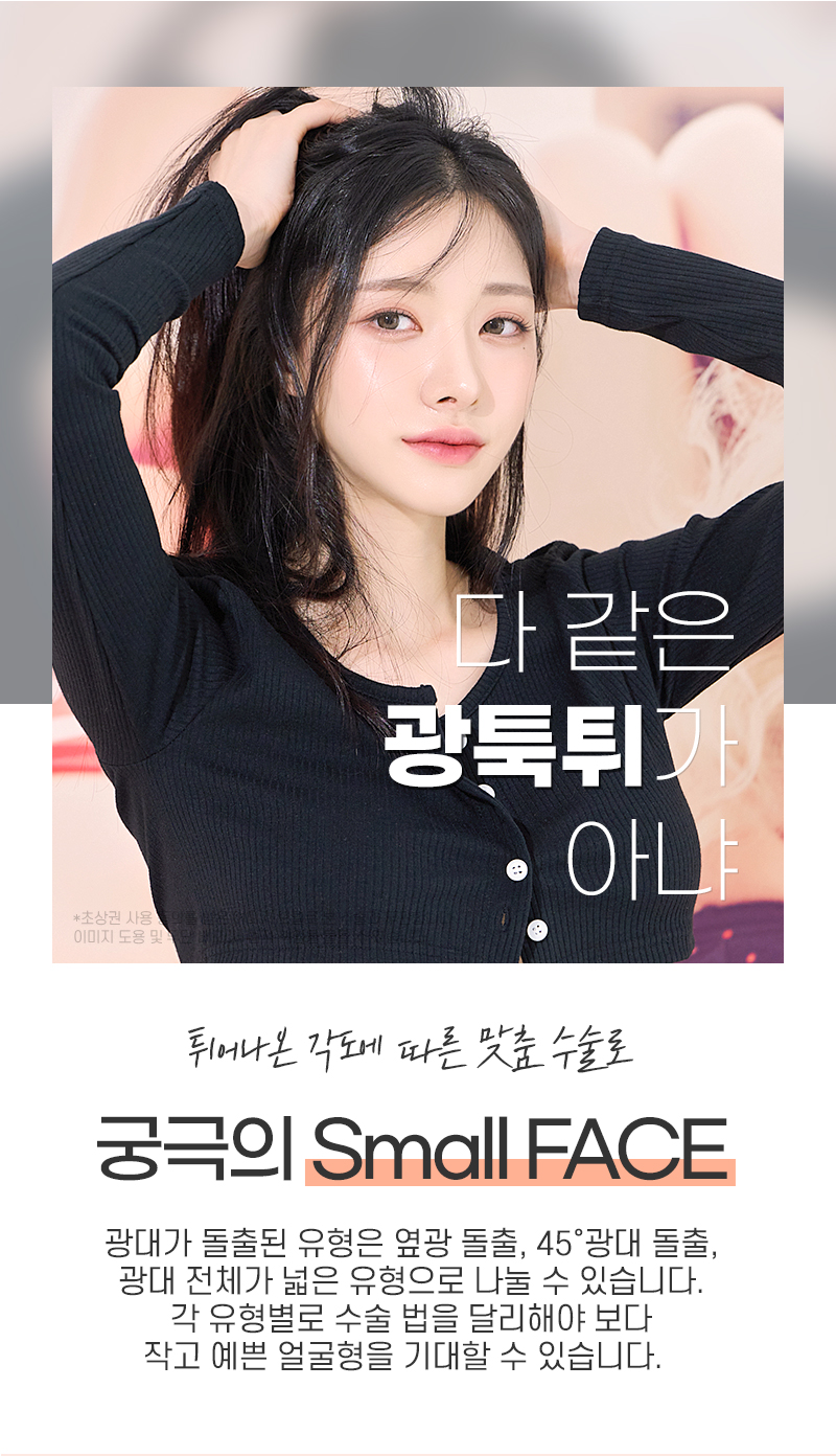 광대축소, 부작용은 줄이고 효과는 높이고 싶다면 관련 이미지 3