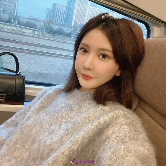 무턱때문에 고민이라면 VIEW로! 관련 이미지 2