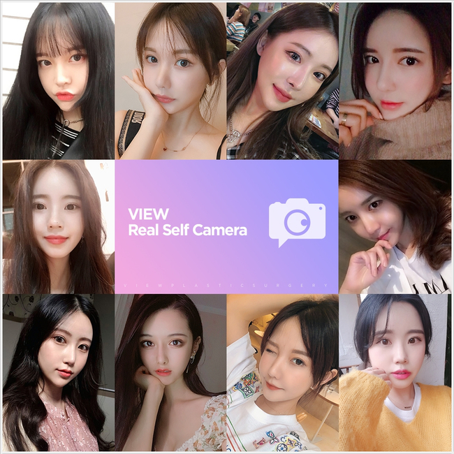 코성형 유의할 점은?(by 뷰성형외과) 관련 이미지 8