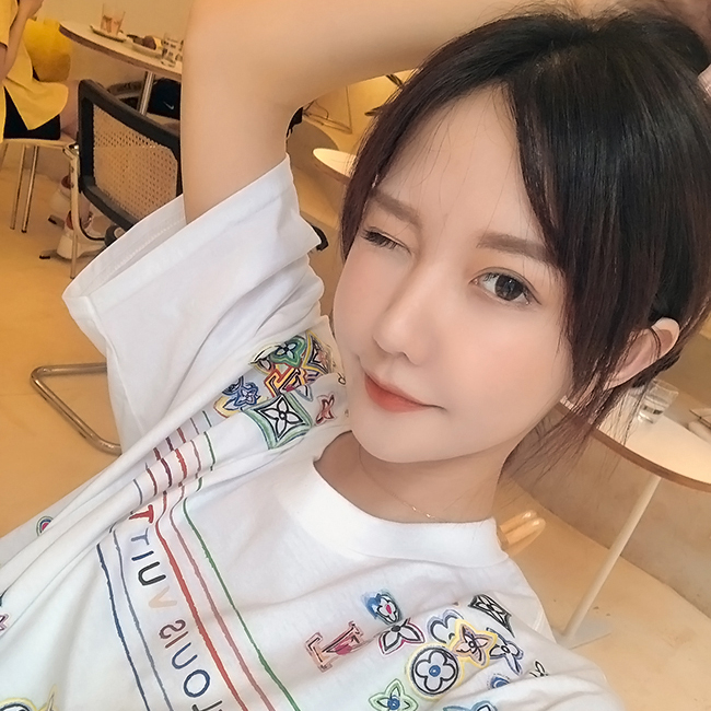 뷰성형외과 얼굴실리프팅 비포애프터의 변화를 원한다면 관련 이미지 2