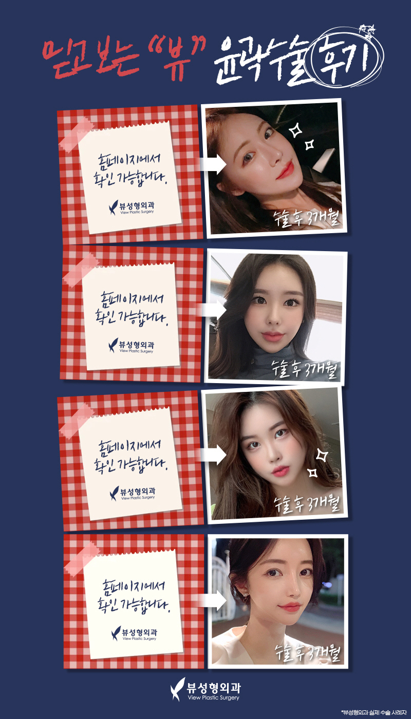 윤곽수술비용보다 안전성을 꼼꼼히 따져야 관련 이미지 13