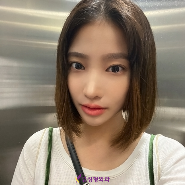 옆광대축소 작은얼굴 바란다면 관련 이미지 6