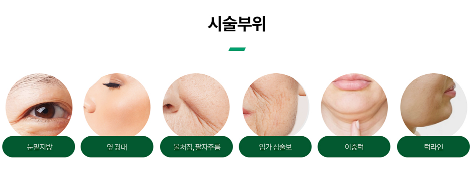 Gangnam Onda Lifting, If You Want to Regain Your V-Line – Dermatology Specialist in Samseong-dong image 7