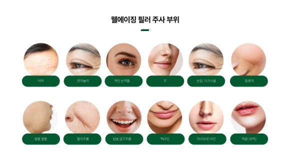 삼성중앙역 피부과(진료과목 : 피부과) 이마부터 턱끝까지, 부위별 필러 적용 방법 - 삼성동 피부과 전문의 관련 이미지 3