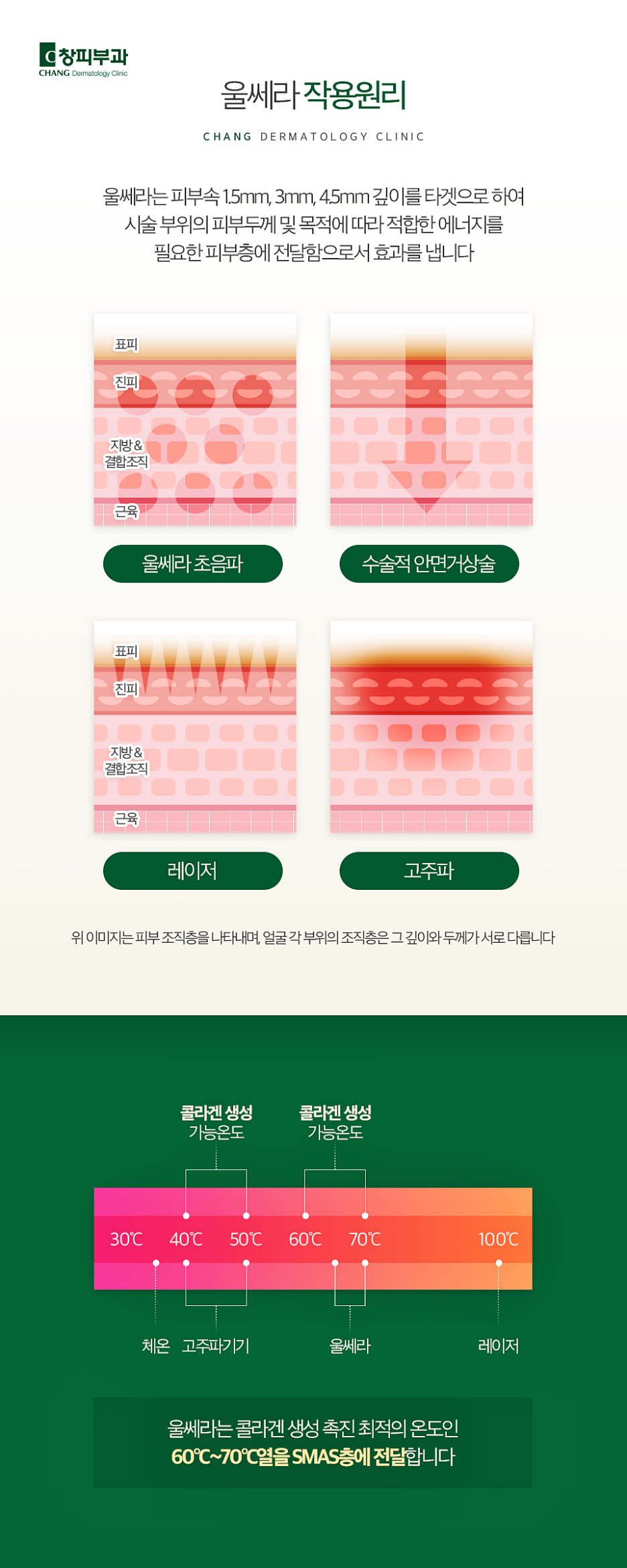울쎄라잘하는병원, 피부과를 알아보고 계시다면? - 삼성동 피부과 전문의 관련 이미지 4