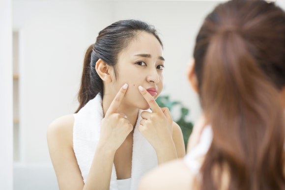 Potenza for Acne Scars image 2