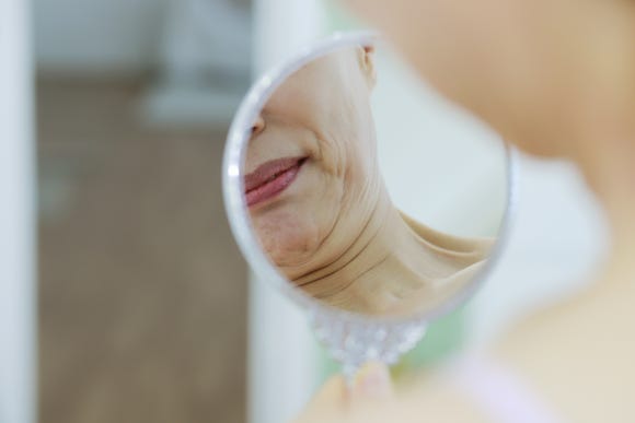 강남브이올렛? 이중턱 개선방법 총정리 - 삼성동 피부과 전문의 관련 이미지 2