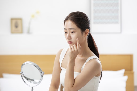 잠실동피부과, 여드름 흉터 치료를 고려하신다면? - 삼성동 피부과 전문의 관련 이미지 2