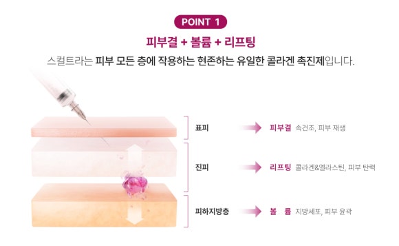 선릉역피부과추천, 스컬트라로 자연스러운 볼륨 개선을 원한다면 - 삼성동 피부과 전문의 관련 이미지 7