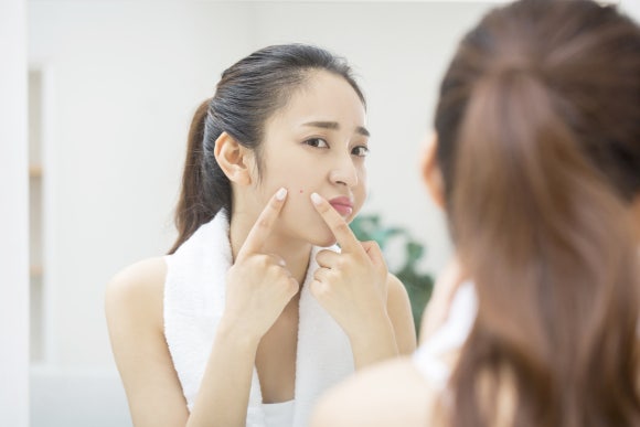 Gangnam Acne Treatment, What If the Acne Is Gone but Marks Remain? — Dermatology Specialist in Samseong-dong image 1