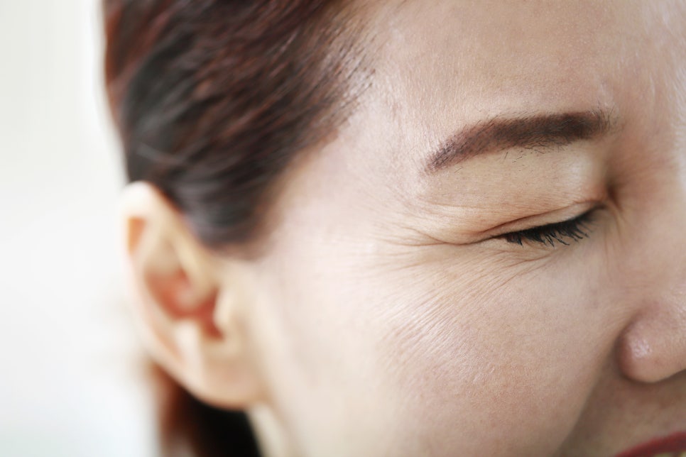 Under-Eye Filler Duration: Understanding Natural Changes and the Flow of Longevity - Dermatology Specialist in Samseong-dong image 1