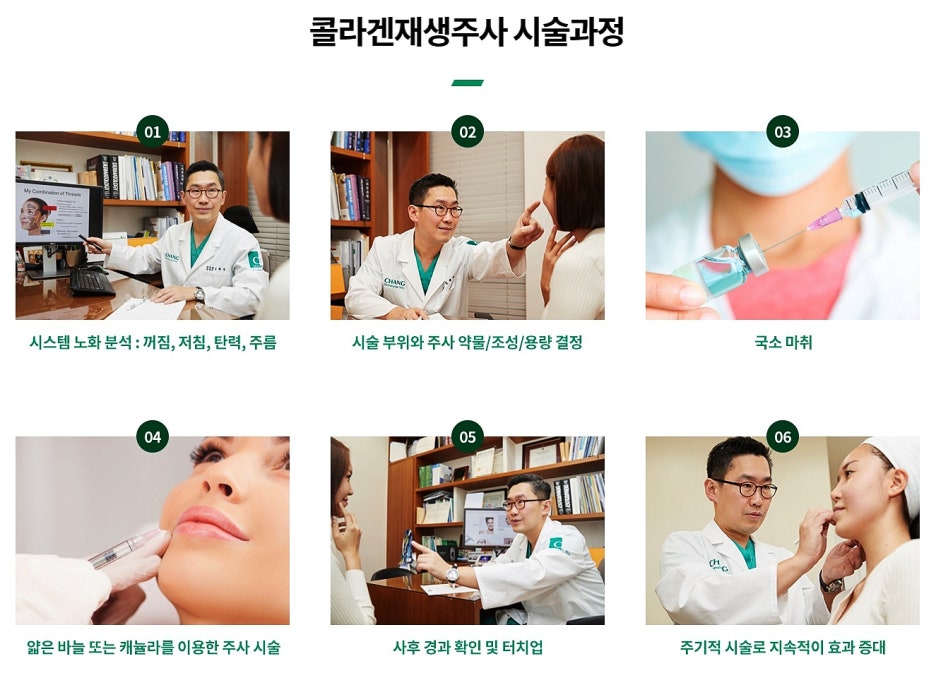 Juvelook Exercise: If You Are Curious About the Precautions – Samsung-dong Dermatology Specialist image 5