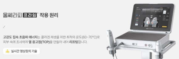 How Does Ultherapy PRIME Differ from the Original Ultherapy? A Comparison of Features by Generation - Samsung-dong Dermatologist image 3