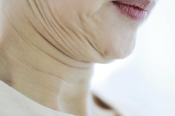 목 가로주름 원인, 연어 성분으로 노화 증상을 개선하는 방법 - 삼성동 피부과 전문의 관련 이미지 2