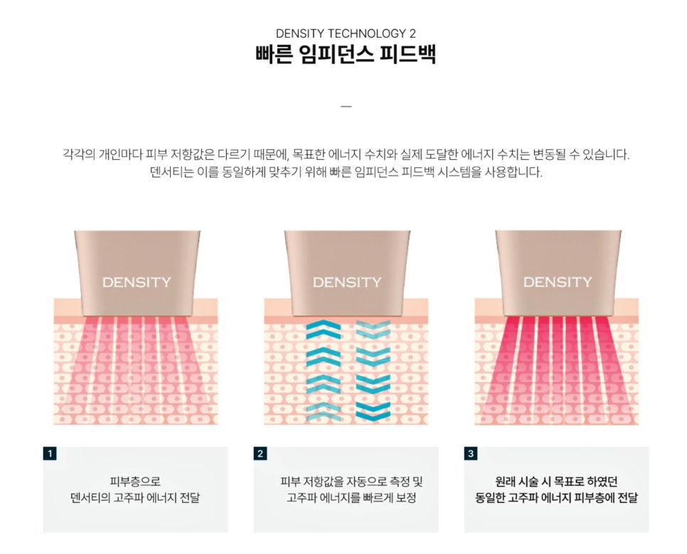 Dermatology Clinic Near Seolleung Station: Key Factors to Check Before a Density Treatment - Samsung-dong Dermatology Specialist image 7