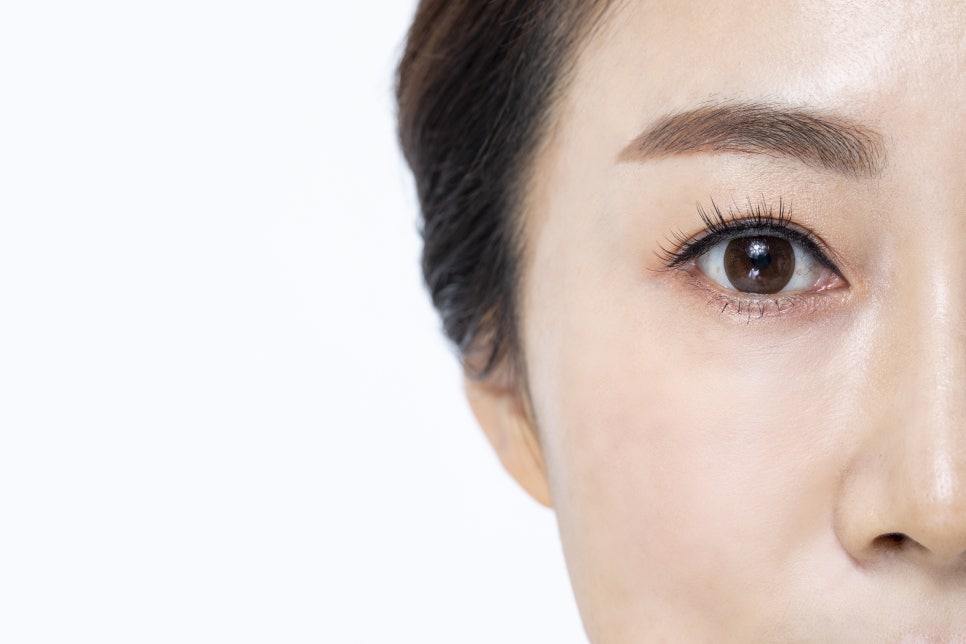 Effects of Botox for Crow’s Feet and Precautions Before Treatment – Dermatology Specialist in Samsung-dong image 6