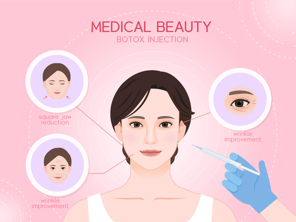 Botox in Samseong-dong: Concerns About Wrinkles image 3