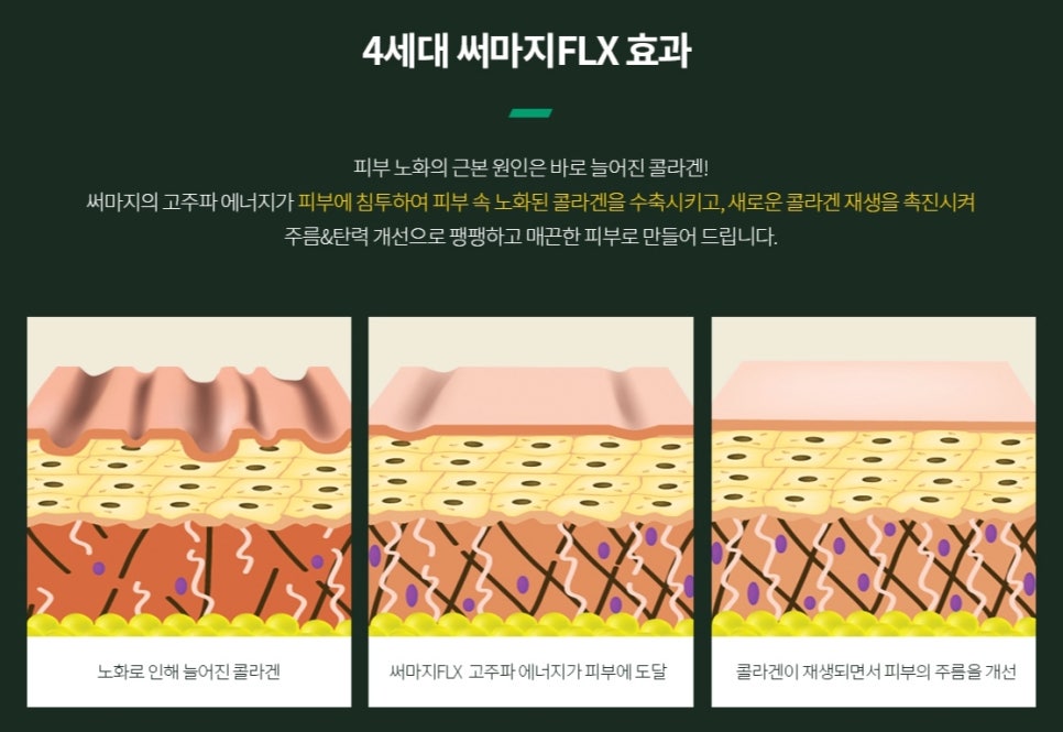 A Complete Guide to Thermage Principles, Effects, and Post-Treatment Precautions! - Dermatology Specialist in Samseong-dong image 5