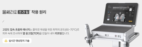 울쎄라프라임 정품팁, 왜 꼭 확인해야 할까요? - 삼성동 피부과 전문의 관련 이미지 5