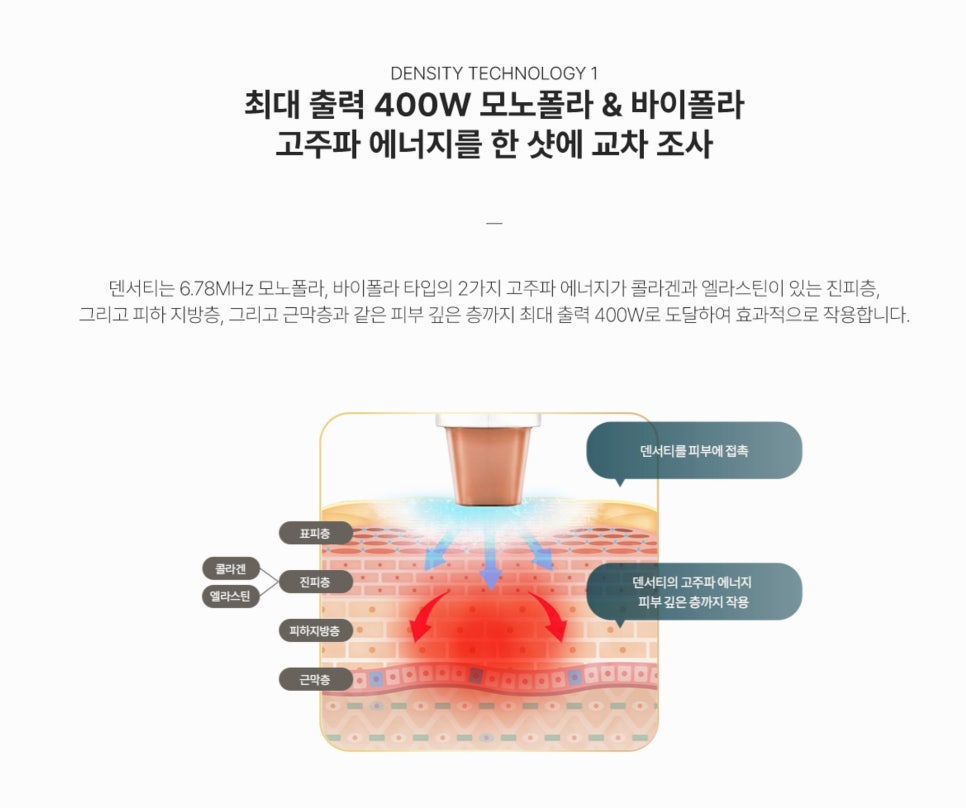 덴서티 알파팁 하이비교, 두 팁의 차이는 무엇일까요? - 삼성동 피부과 전문의 관련 이미지 4