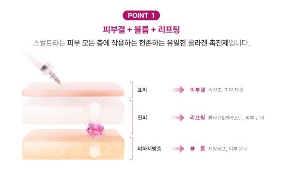 이마 스컬트라, 자연스러운 볼륨 변화를 원하신다면? - 삼성동 피부과 전문의 관련 이미지 4