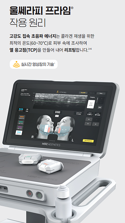 Ultherapy PRIME Differences: A Clear Summary of How It Differs from Ultherapy – Samseong-dong Dermatology Specialist image 4