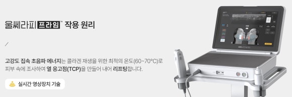 Gangnam Ulthera Prime Effect: How Is It Different from a Regular Ulthera Procedure? - Dermatology Specialist in Samseong-dong image 2