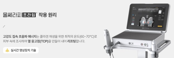 강남울쎄라프라임, 초음파로 피부 깊이를 확인하며 진행하는 이유 - 삼성동 피부과 전문의 관련 이미지 2