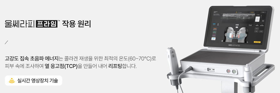 강남울쎄라프라임, 일반 울쎄라와 어떤 점이 다를까요? - 삼성동 피부과 전문의 관련 이미지 7