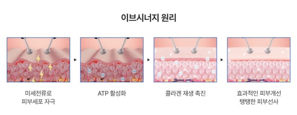 삼성역피부과추천, 이브시너지로 피부 컨디션까지 함께 관리하는 방법 - 삼성동 피부과 전문의 관련 이미지 5