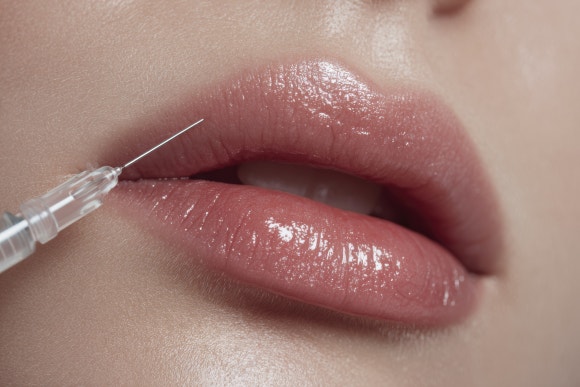 Samseong-dong Filler: How Can Lip Filler Create a Natural Lip Line? - Dermatology Specialist in Samseong-dong image 6