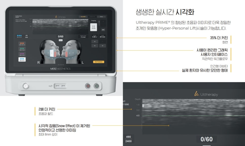 Ultherapy PRIME Treatment Interval and Effects—Learn Everything at Once from a Dermatology Specialist in Samseong-dong image 5
