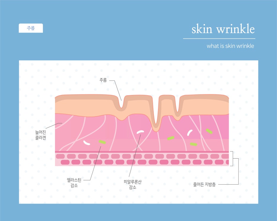 Causes of Horizontal Neck Lines image 3