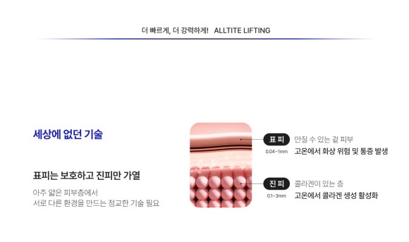 올타이트 주기, 피부 상태에 따라 관리 간격이 달라지는 이유 - 삼성동 피부과 전문의 관련 이미지 5