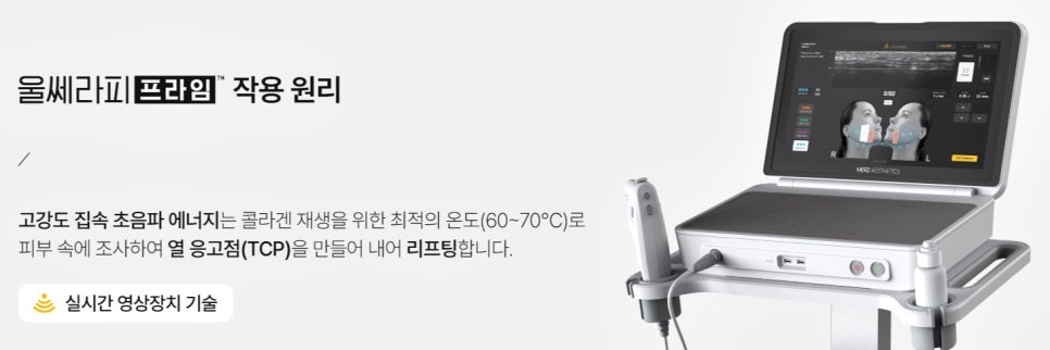 선정릉역피부과, 창피부과에서 알려드리는 리프팅 전 알아야 할 핵심 - 삼성동 피부과 전문의 관련 이미지 4