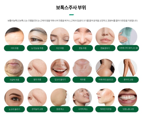 삼성역근처피부과 보톡스 시술 전 관련 이미지 4
