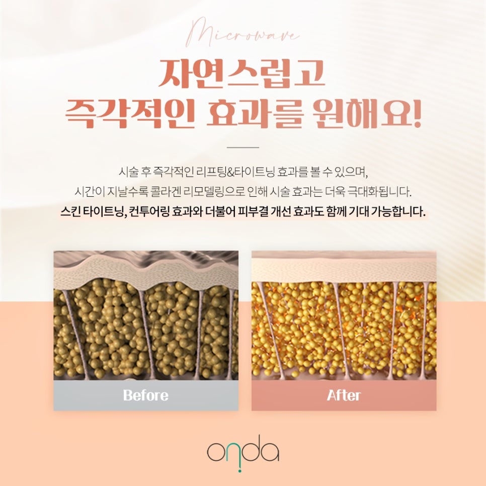 삼성역온다리프팅, 피부 탄력 저하가 느껴질 때 알아두면 좋은 꿀팁 정보 - 삼성동 피부과 전문의 관련 이미지 12
