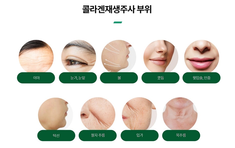 COEX Dermatology: Effective for Stimulating Your Own Collagen Production image 6