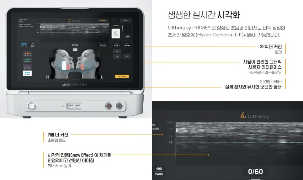 Ultherapy Prime Effects: Want to Increase Your Satisfaction? - Dermatology Specialist in Samseong-dong image 3