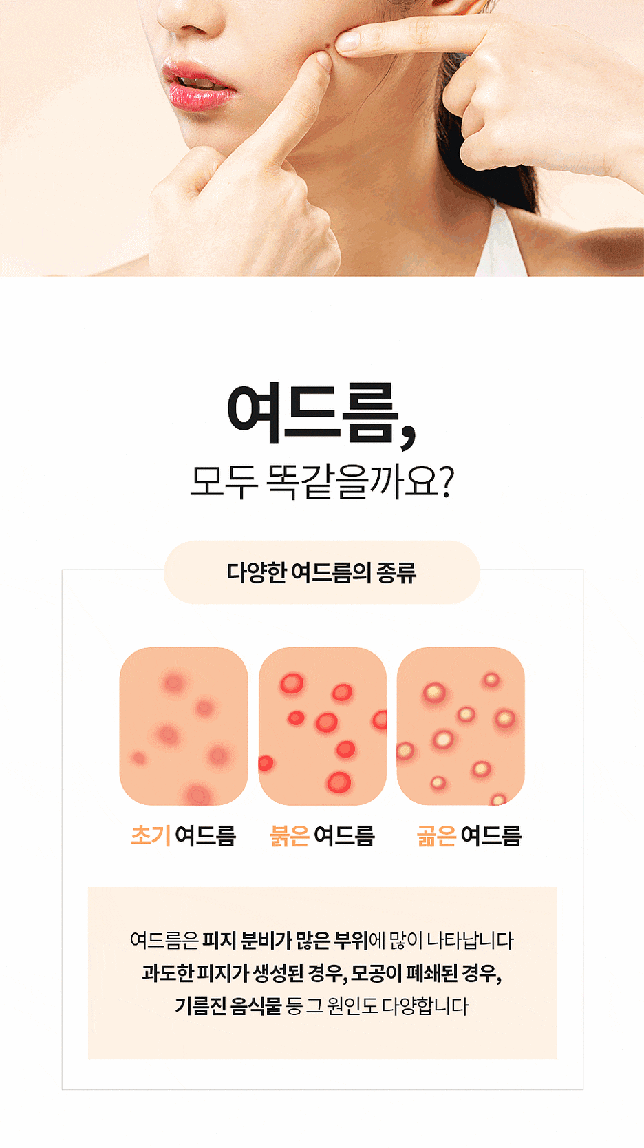 Dermatology Clinic Near Samseong Station: If You Are Concerned About Enlarged Pores and Uneven Skin – Dermatology Specialist in Samseong-dong image 3