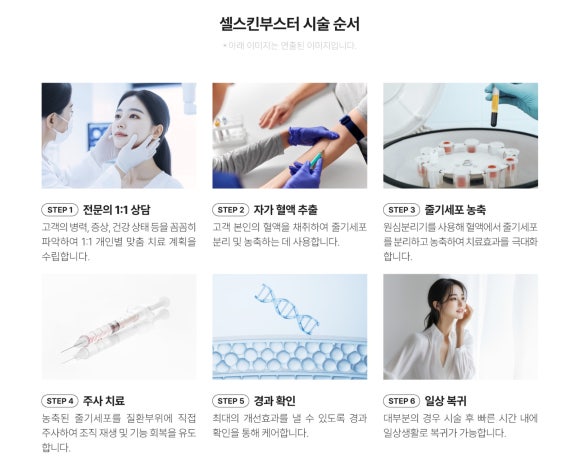 강남대치동피부과 셀스킨부스터, 피부가 원하는 성분을 세밀하게 채우는 방법 - 삼성동 피부과 전문의 관련 이미지 7