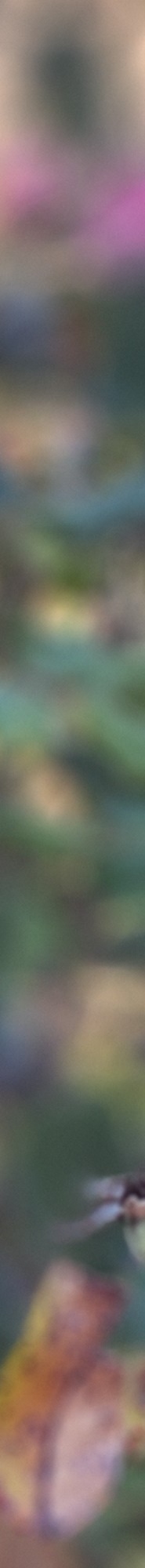 인중축소후기 비율에 맞는 예쁜 입술라인을 위해 관련 이미지 18
