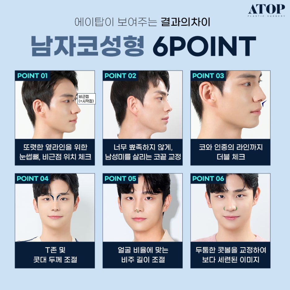 남자눈코성형 티 나지 않게 하는 것이 관건 관련 이미지 3