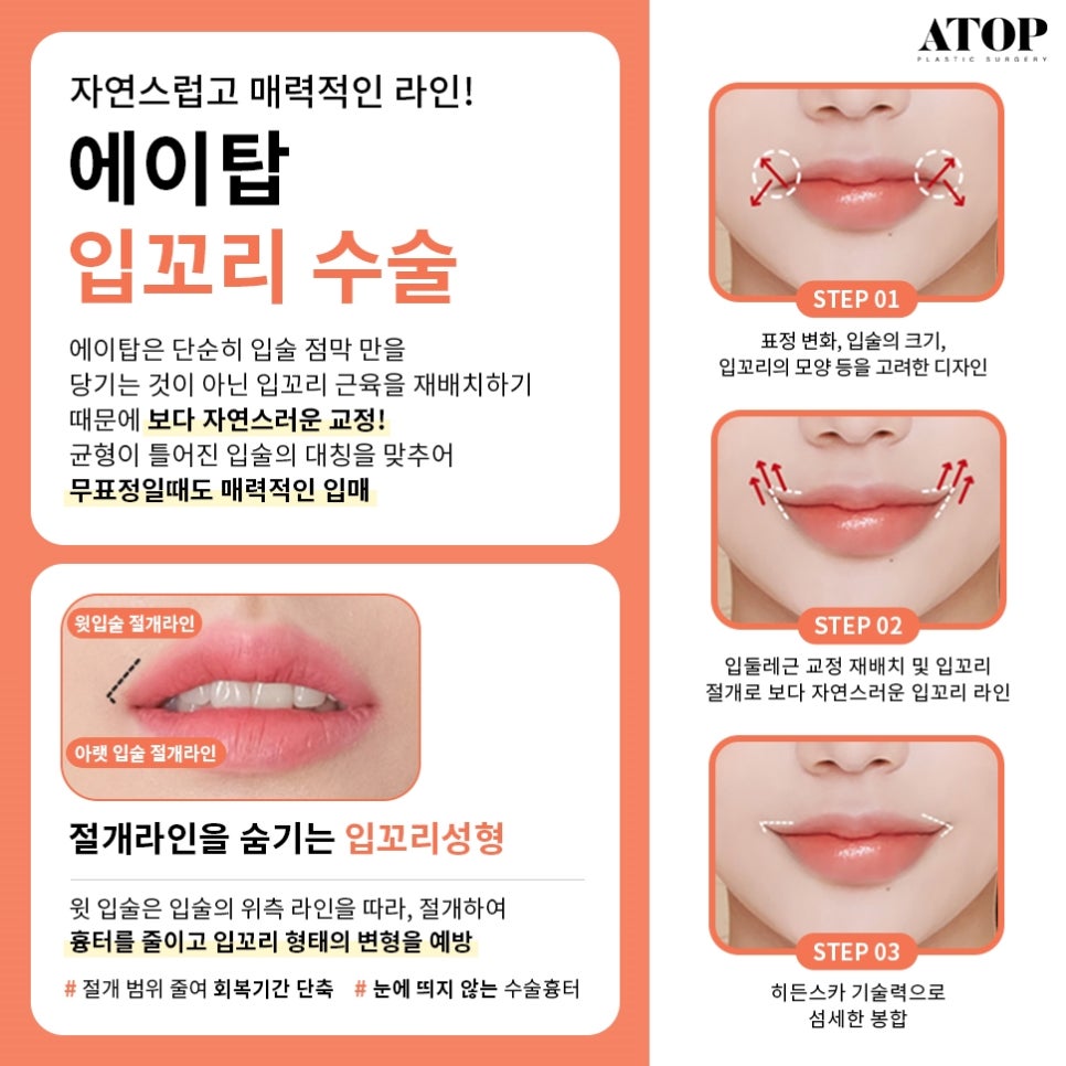 인중축소후기 비율에 맞는 예쁜 입술라인을 위해 관련 이미지 3