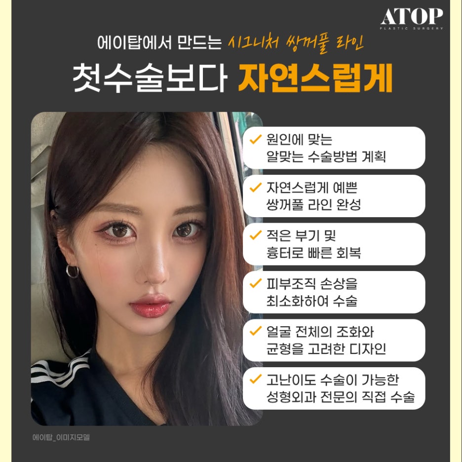 눈재수술병원 내 눈에 집중한 맞춤 수술 관련 이미지 5